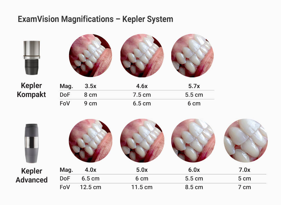 Visão geral do Kepler Advanced e do Kepler Kompakt