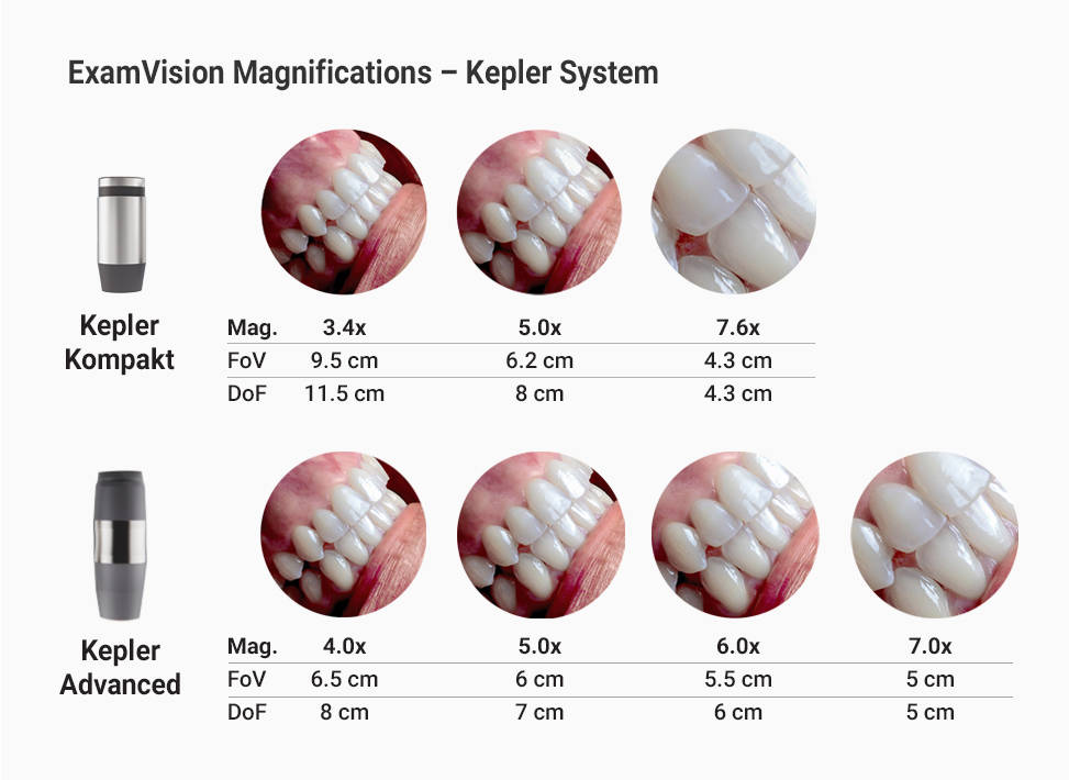 Aperçu de Kepler Advanced et Kepler Kompakt
